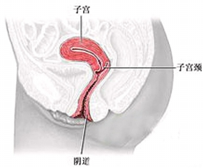 宫颈癌化疗后要怎么护理?