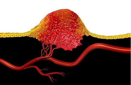 Ƥ���۰����ճ�����