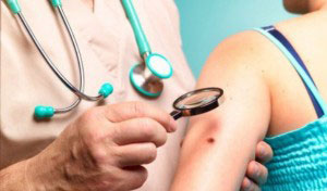 Ƥ���۰����ճ�������֪